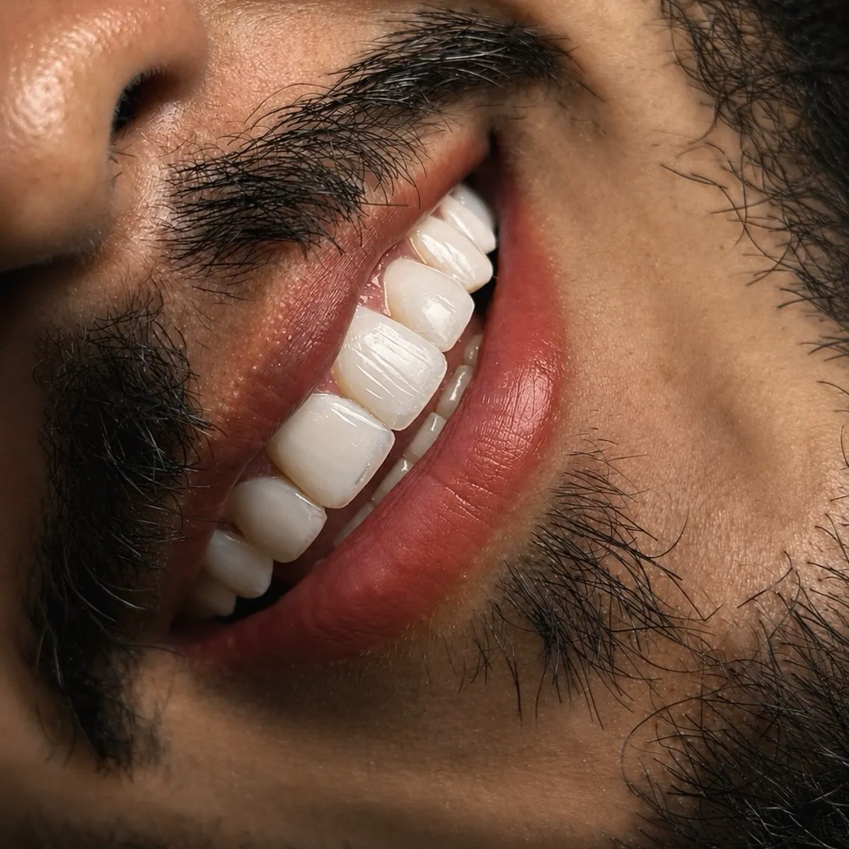 Resultado de facetas