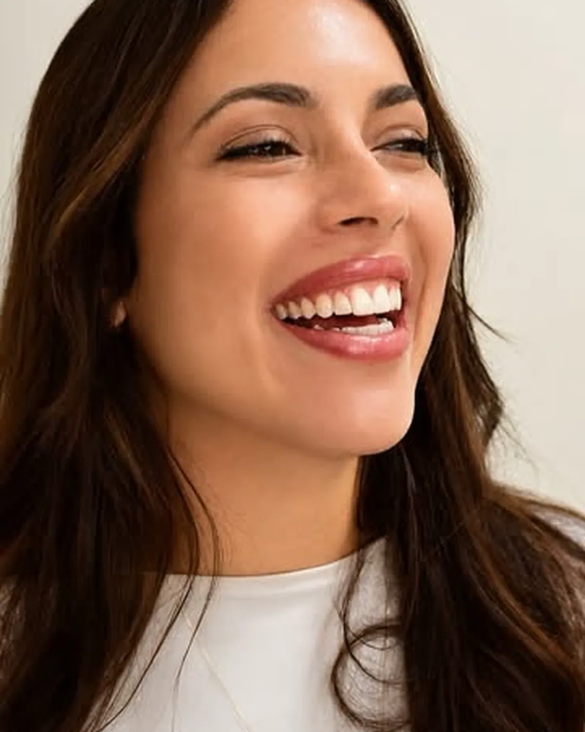 Sorriso natural após o tratamento